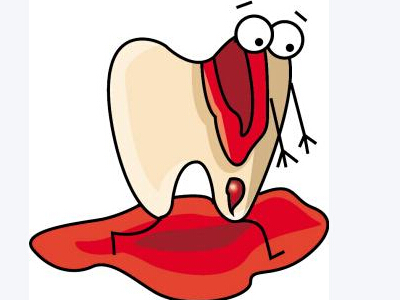 漳州牙齦出血有什么危害