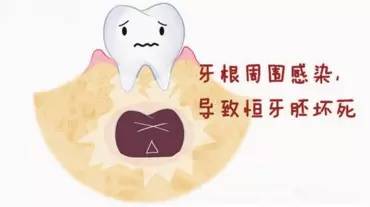 ��������������ԭ������Щ