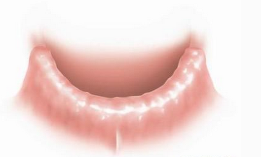 漳州牙齒全口缺失的危害有哪些