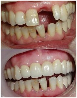 �����T��ȱʧ����Щ�ޏ�(f��)��ʽ