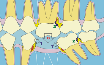 �������Xȱʧ����Щ�ޏ�(f��)��ʽ��