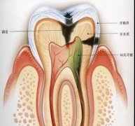 �a(b��)���͸����ί��кβ�ͬ��